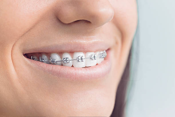 Best Dental Fillings (Composite and Amalgam)  in North Madison, OH